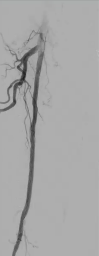 passeo18lux_tab1_img2